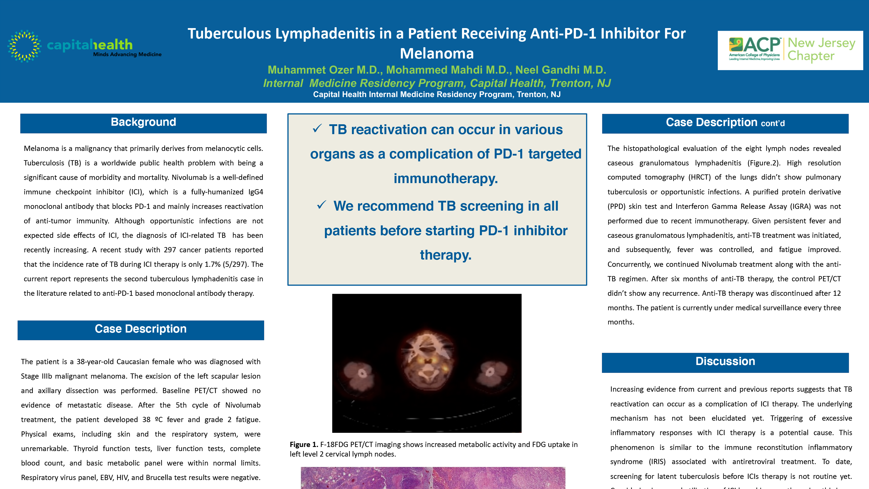 23-CV-57-Tuberculous Lymphadenitis in a Patient Receiving Anti-PD-1